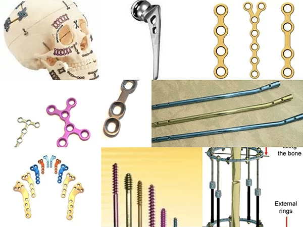 orthopedic implants